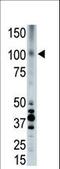 LDL Receptor Related Protein 8 antibody, LS-C100409, Lifespan Biosciences, Western Blot image 