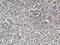 TNF Superfamily Member 11 antibody, 66610-1-Ig, Proteintech Group, Immunohistochemistry paraffin image 