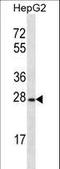 Olfactory Receptor Family 8 Subfamily B Member 12 antibody, LS-C163252, Lifespan Biosciences, Western Blot image 