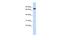 Ankyrin Repeat Domain 13B antibody, A15003, Boster Biological Technology, Western Blot image 