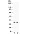Thymidine Kinase 1 antibody, R31883, NSJ Bioreagents, Western Blot image 
