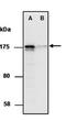 SWI/SNF Related, Matrix Associated, Actin Dependent Regulator Of Chromatin Subfamily C Member 2 antibody, orb66714, Biorbyt, Western Blot image 