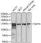 Smoothelin antibody, GTX32885, GeneTex, Western Blot image 