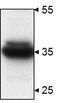 STIP1 Homology And U-Box Containing Protein 1 antibody, PA1-015, Invitrogen Antibodies, Western Blot image 