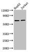 RUNX1T1 ETO antibody, CSB-PA726765HA01HU, Cusabio, Western Blot image 