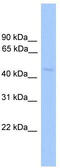 Nuclear Receptor Subfamily 1 Group H Member 2 antibody, TA338112, Origene, Western Blot image 