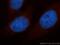 Ubiquinol-Cytochrome C Reductase Core Protein 2 antibody, 14742-1-AP, Proteintech Group, Immunofluorescence image 