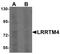 Leucine Rich Repeat Transmembrane Neuronal 4 antibody, PA5-21101, Invitrogen Antibodies, Western Blot image 