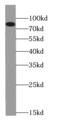 Carnitine Palmitoyltransferase 1B antibody, FNab01944, FineTest, Western Blot image 