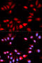 Regulator Of Calcineurin 1 antibody, 19-590, ProSci, Immunofluorescence image 