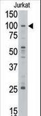 MLLT10 Histone Lysine Methyltransferase DOT1L Cofactor antibody, LS-C100427, Lifespan Biosciences, Western Blot image 