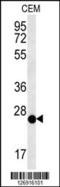 Cysteine Rich Secretory Protein LCCL Domain Containing 2 antibody, 61-978, ProSci, Western Blot image 