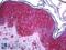 c-Kit antibody, LS-B6058, Lifespan Biosciences, Immunohistochemistry paraffin image 