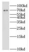 IlvB Acetolactate Synthase Like antibody, FNab04292, FineTest, Western Blot image 