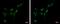 6-Phosphofructo-2-Kinase/Fructose-2,6-Biphosphatase 3 antibody, PA5-32013, Invitrogen Antibodies, Immunofluorescence image 