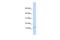 Plasminogen Receptor With A C-Terminal Lysine antibody, GTX46093, GeneTex, Western Blot image 