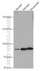 Potassium Voltage-Gated Channel Subfamily Q Member 2 antibody, 66774-1-Ig, Proteintech Group, Western Blot image 