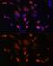 Transmembrane P24 Trafficking Protein 10 antibody, GTX33548, GeneTex, Immunocytochemistry image 