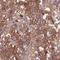 Stress Induced Phosphoprotein 1 antibody, NBP2-32621, Novus Biologicals, Immunohistochemistry frozen image 