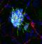 Doublecortin antibody, LS-C204512, Lifespan Biosciences, Immunocytochemistry image 