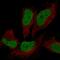 ATRX Chromatin Remodeler antibody, PA5-51656, Invitrogen Antibodies, Immunofluorescence image 