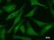 CCCTC-Binding Factor antibody, LS-C342619, Lifespan Biosciences, Immunofluorescence image 