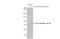 NDC80 Kinetochore Complex Component antibody, GTX70017, GeneTex, Western Blot image 