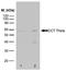 Chaperonin Containing TCP1 Subunit 8 antibody, SM2017P, Origene, Western Blot image 