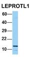 Nucleolar Protein Interacting With The FHA Domain Of MKI67 antibody, orb382451, Biorbyt, Western Blot image 