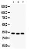 Complement C1q Binding Protein antibody, PB9921, Boster Biological Technology, Western Blot image 