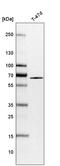 SHOC2 Leucine Rich Repeat Scaffold Protein antibody, HPA009164, Atlas Antibodies, Western Blot image 
