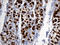 TFF1 antibody, LS-C793820, Lifespan Biosciences, Immunohistochemistry paraffin image 