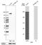 Tight Junction Protein 2 antibody, NBP1-86850, Novus Biologicals, Western Blot image 