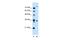 Transmembrane Protein 231 antibody, PA5-42686, Invitrogen Antibodies, Western Blot image 