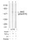 AKT Serine/Threonine Kinase 2 antibody, ab38513, Abcam, Western Blot image 