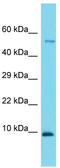 Coiled-Coil Domain Containing 167 antibody, TA332167, Origene, Western Blot image 