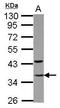 General Transcription Factor IIE Subunit 2 antibody, GTX105029, GeneTex, Western Blot image 