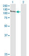 Minichromosome Maintenance Complex Component 2 antibody, LS-C197660, Lifespan Biosciences, Western Blot image 