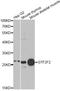 General Transcription Factor IIF Subunit 2 antibody, LS-C748546, Lifespan Biosciences, Western Blot image 