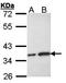 OTU Deubiquitinase, Ubiquitin Aldehyde Binding 1 antibody, orb69715, Biorbyt, Western Blot image 
