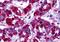 G Protein-Coupled Estrogen Receptor 1 antibody, orb85961, Biorbyt, Immunohistochemistry paraffin image 