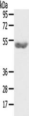 GPAT4 antibody, TA351863, Origene, Western Blot image 