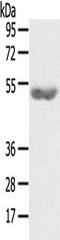 GPAT4 antibody, TA351863, Origene, Western Blot image 