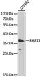 PHD Finger Protein 11 antibody, LS-C748480, Lifespan Biosciences, Western Blot image 