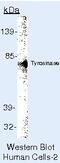Tyrosinase antibody, MA5-14174, Invitrogen Antibodies, Western Blot image 