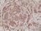 Actinin Alpha 4 antibody, NBP2-61485, Novus Biologicals, Immunohistochemistry paraffin image 