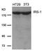 Insulin Receptor Substrate 1 antibody, GTX50551, GeneTex, Western Blot image 