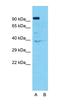Twinkle protein, mitochondrial antibody, orb324646, Biorbyt, Western Blot image 