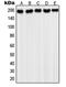 Platelet Derived Growth Factor Receptor Alpha antibody, MBS821212, MyBioSource, Western Blot image 