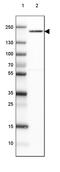 Ubiquitin Specific Peptidase 32 antibody, PA5-60690, Invitrogen Antibodies, Western Blot image 